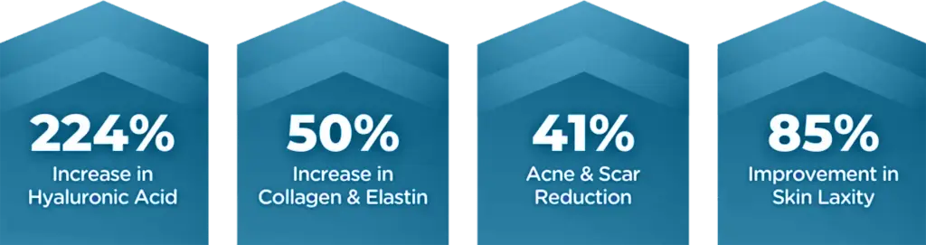 exion stats1 1 1024x271 1 copy 2